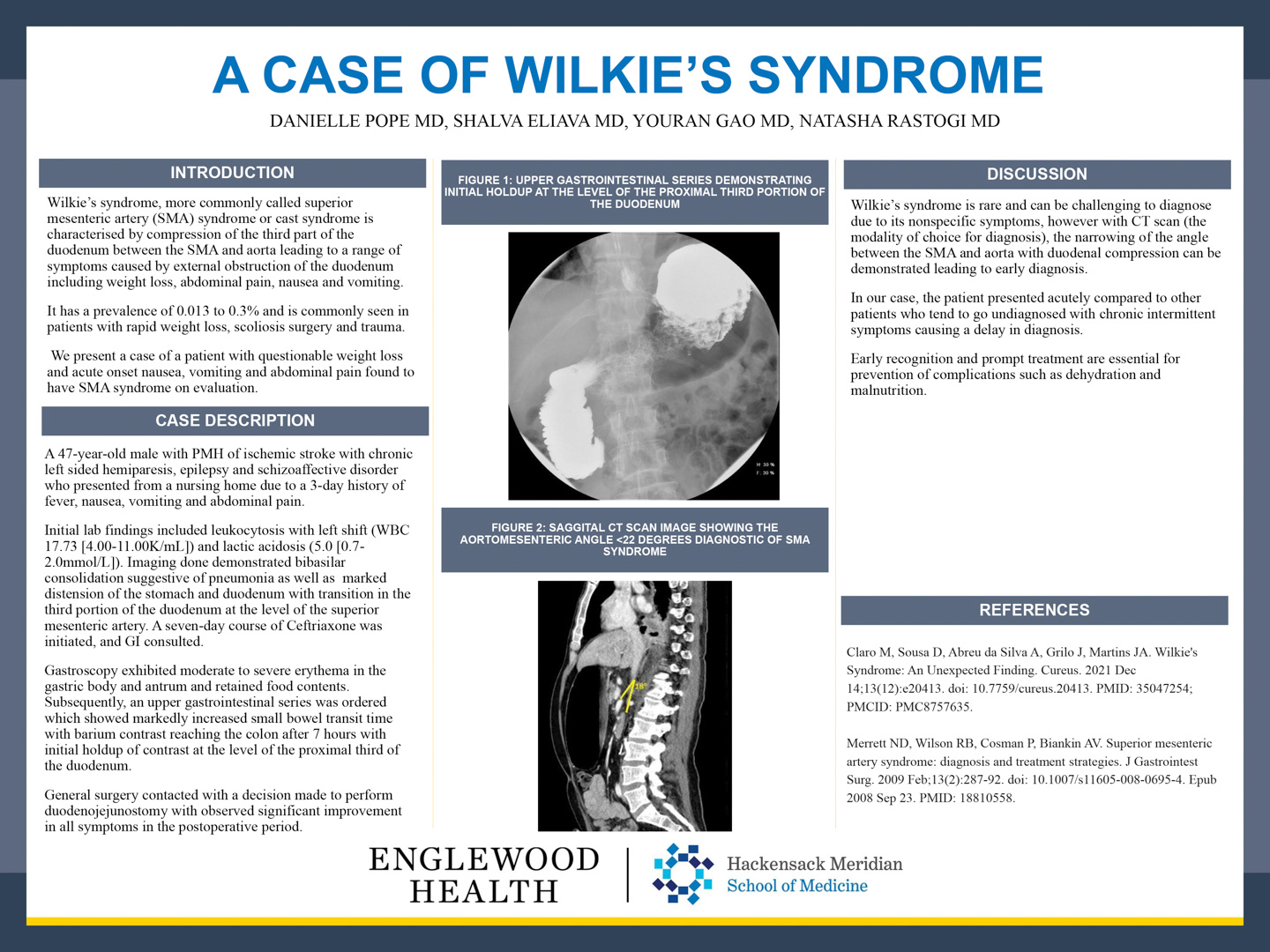 Image of poster - A Case of Wilkie's Syndrome