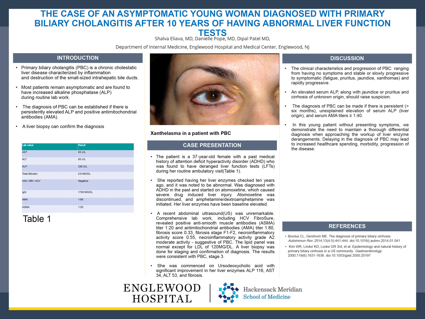 Image of poster - The Case Of An Asymptomatic Young Woman Diagnosed With Primary Biliary Cholangitis After 10 Years Of Having Abnormal Liver Function Tests
