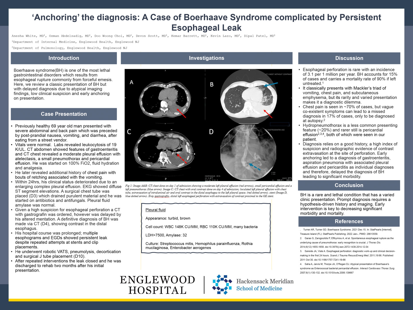 Image of poster - Anchoring the Diagnosis: A Case of Boerhaave Syndrome Complicated by Persistent Esophageal Leak