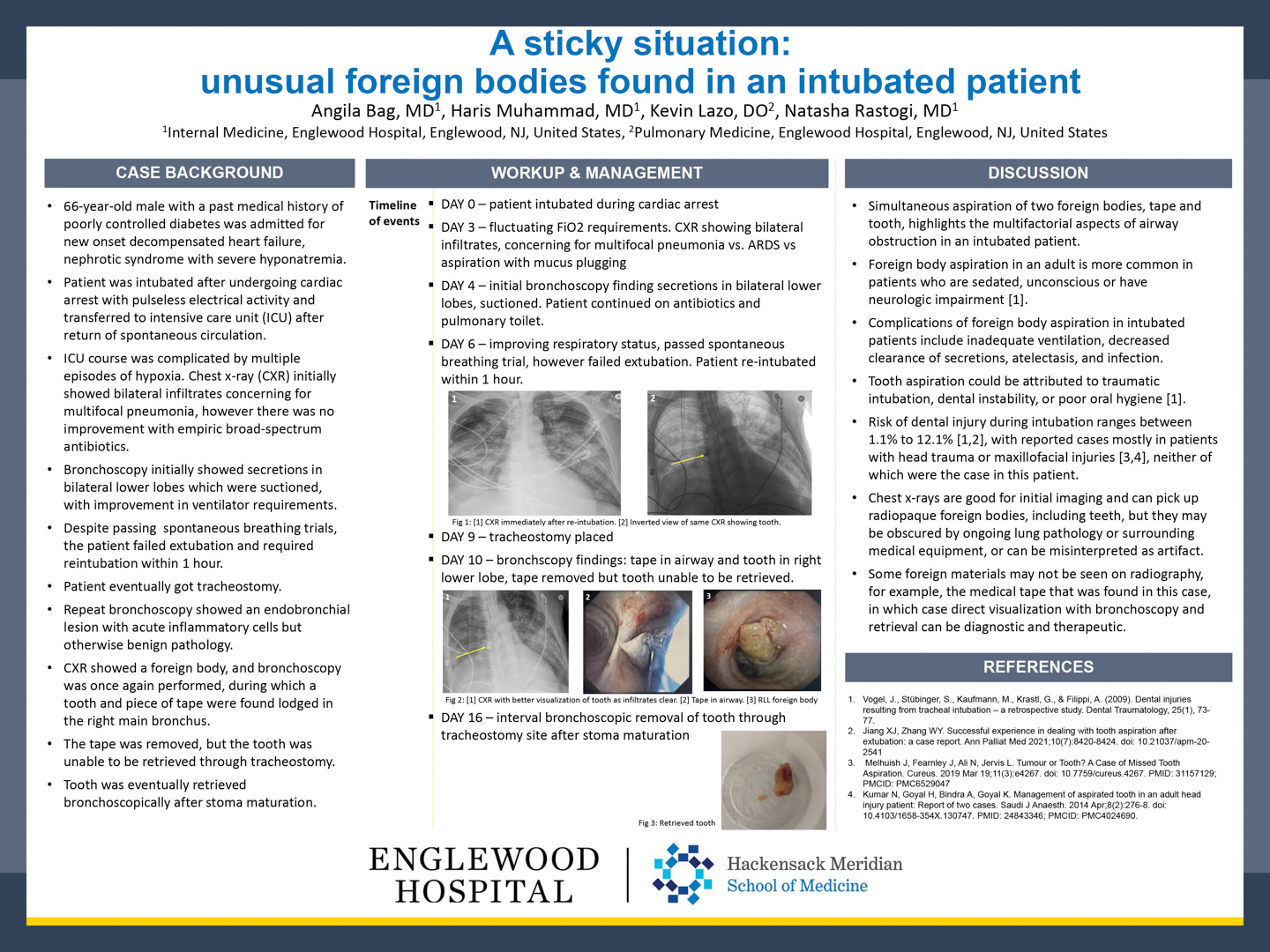Image of poster - A Sticky Situation: Unusual Foreign Bodies Found in an Intubated Patient
