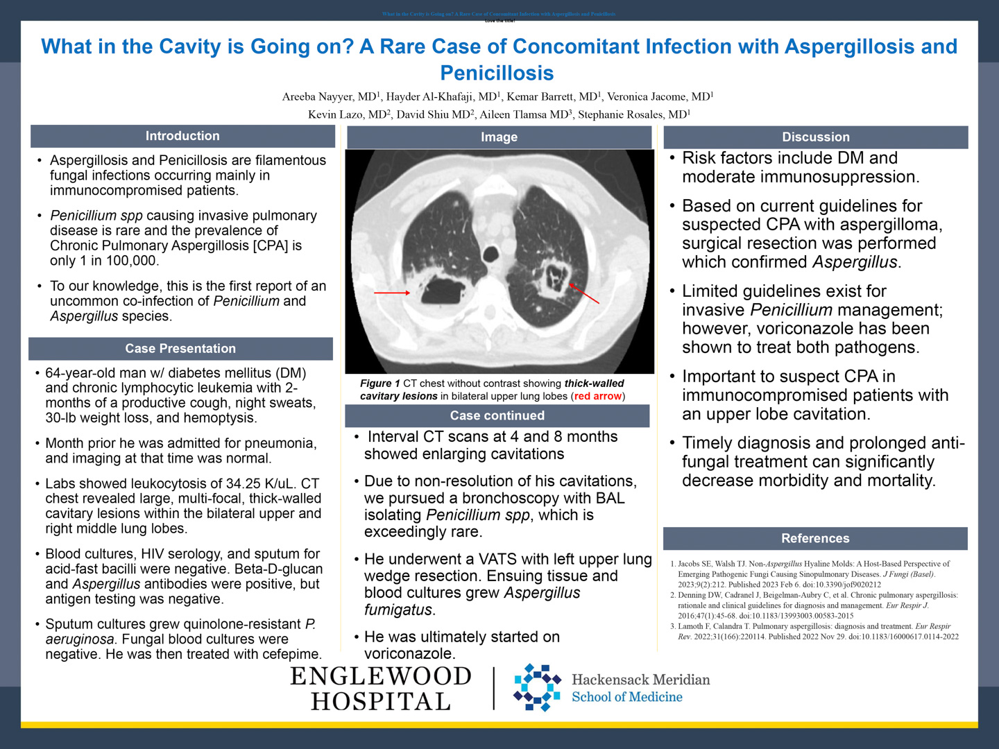 Image of poster - What in the Cavity is Going on? A Rare Case of Concomitant Infection with Aspergillosis and Penicillosis